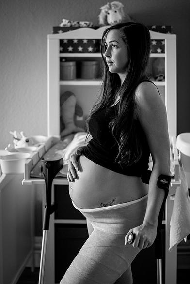 Schwangere Frau mit einem Beckengips