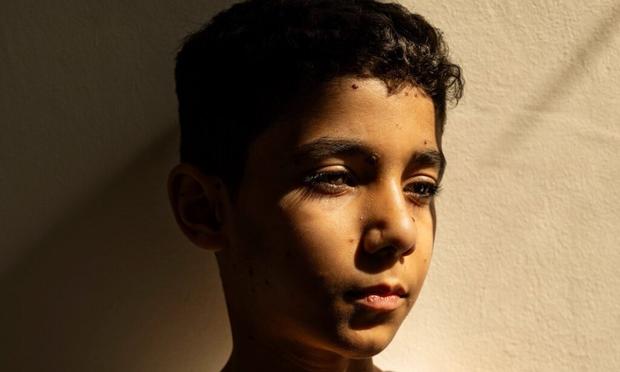 Palestinian photojournalist Samar Abu Elouf wins World Press Photo with image of young Gazan amputee - The Art Newspaper