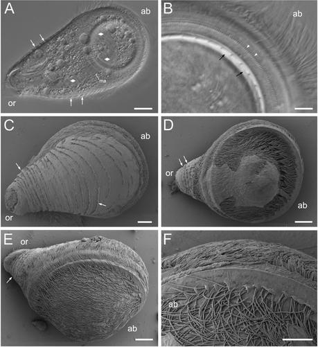 microscopic pictures of a complicated single-celled organism covered in thin hairs