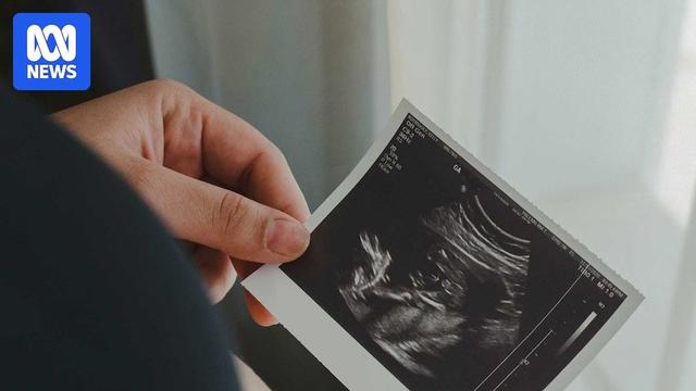 Unidentified woman in forground with left hand holding black and white holding ultrasound of baby scan