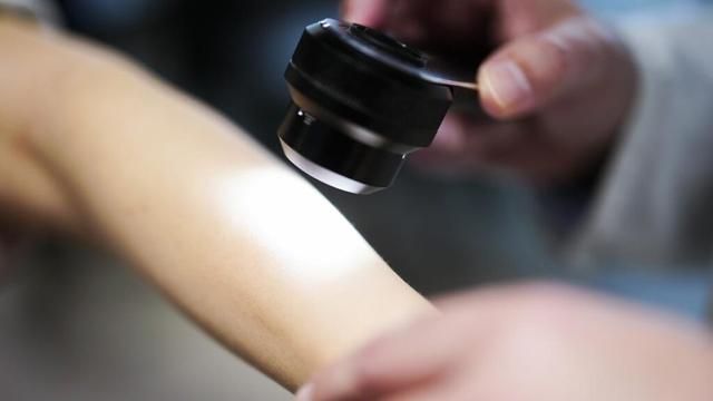 UV-Strahlung: Hoher Anstieg von Hautkrebsfällen - Zeit Online