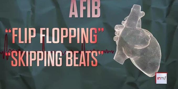 Alternative to blood thinners providing AFib patients the same protection from stroke