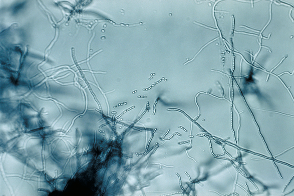 Image of Streptomyces, the taxon in which the compound is found.