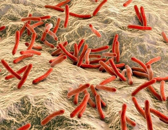 Genetic analysis shows leprosy was endemic in pre-colonial America