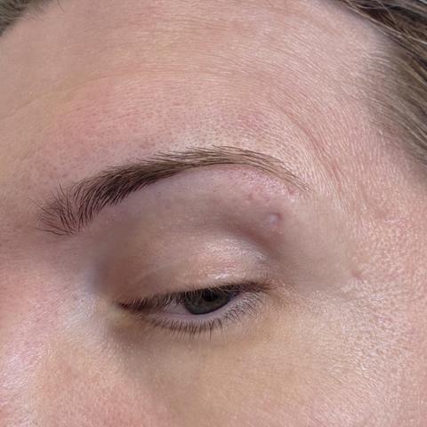 My eyebrow, showing the scar beneath it