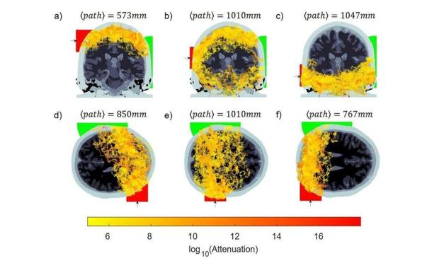 Scientists detect light passing through entire human head, opening new doors for brain imaging