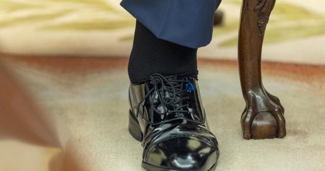 What to know about President Tump's 'chronic venous insufficiency'